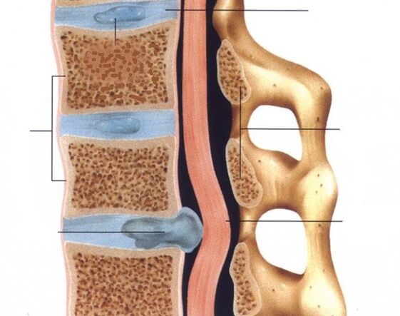 Las hernias se pronuncian