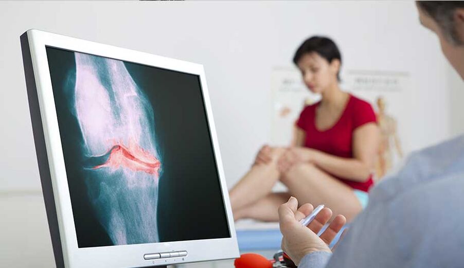 Consulta con un médico si se sospecha artritis u osteoartritis