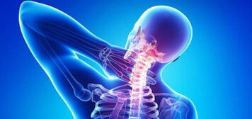 Causas de osteocondosis cervical