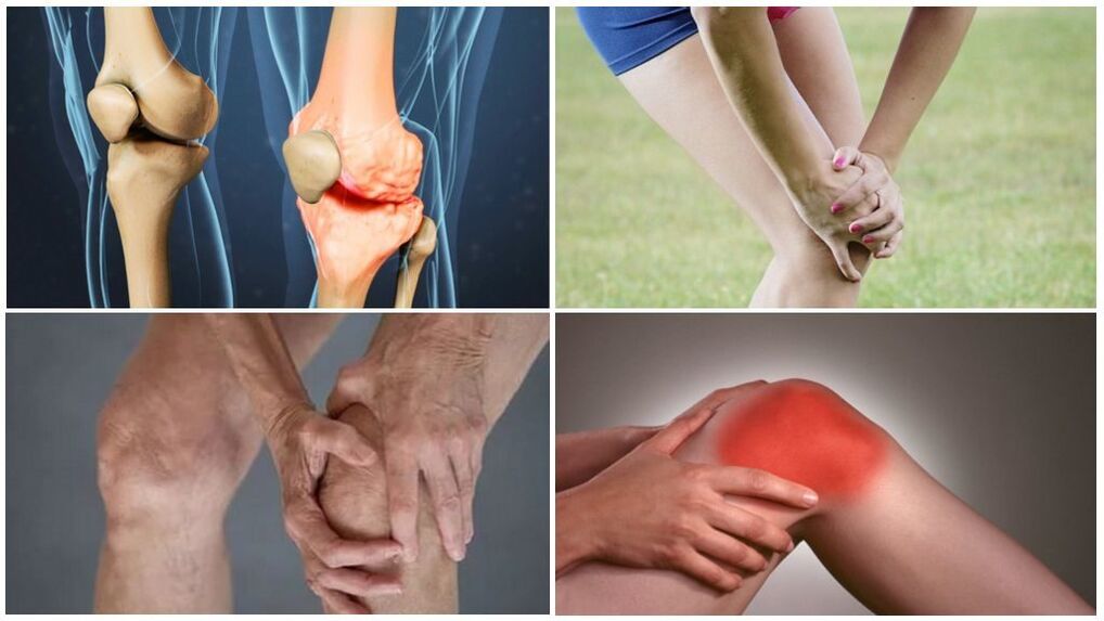 Fase de osteoartritis