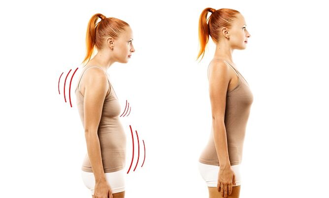 inclinado como la causa del desarrollo de la osteocondosis lumbar