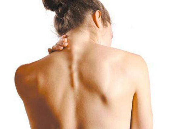 La niña tiene osteocondrosis cervical.