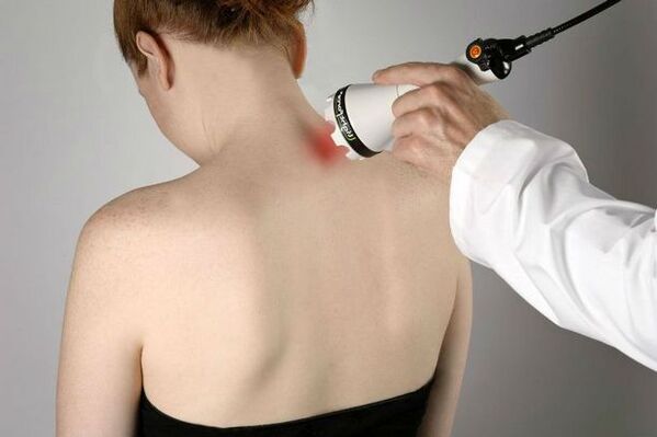 Medidas fisioterapéuticas para el tratamiento de la osteocondrosis cervical.