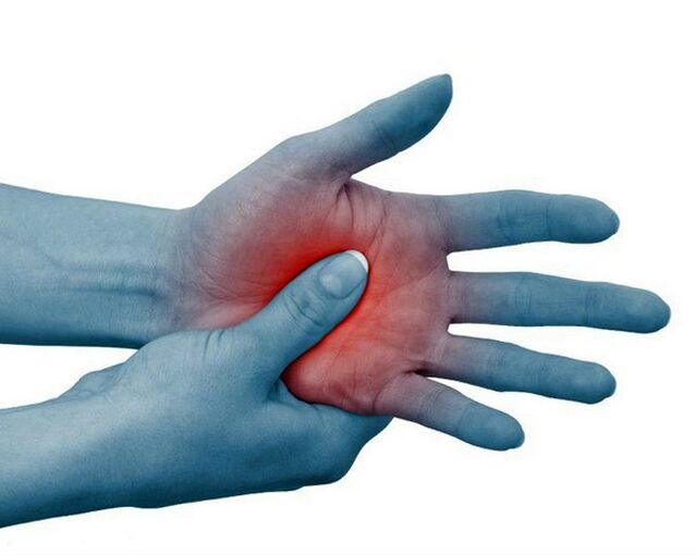 El dolor intenso en las articulaciones de los dedos, que disminuye con el ejercicio, es un signo típico de la artritis reumatoide.